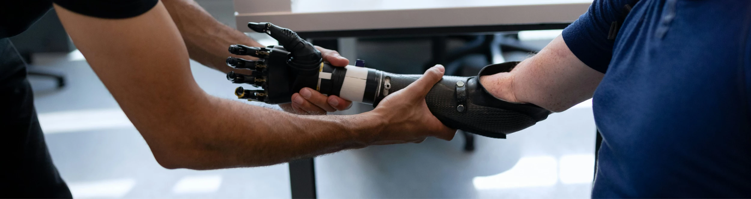 Arm Prostheses
