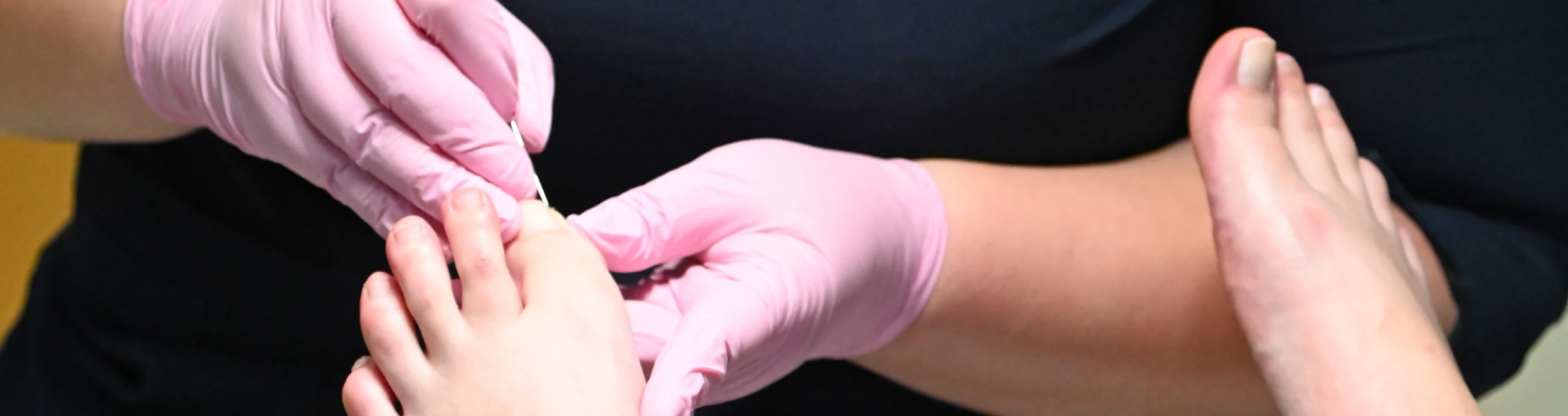 Podologische Komplexbehandlung
